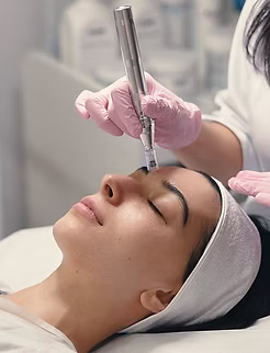 Is Microneedling Safe_ Most Common Risks And Benefits